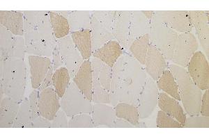 Human skeletal muscle: immunohistochemical staining for Myotilin. (Myotilin anticorps  (C-Term))