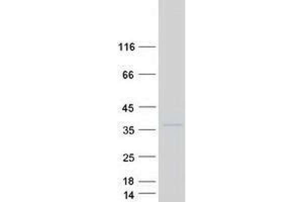 TTC35 Protein (Myc-DYKDDDDK Tag)