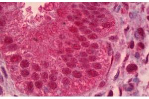 Anti-PAX9 antibody IHC staining of human uterus, endometrium. (PAX9 anticorps)