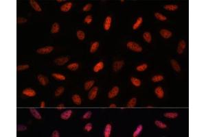 Immunofluorescence analysis of U-2 OS cells using ARID1B Polyclonal Antibody at dilution of 1:100. (ARID1B anticorps)