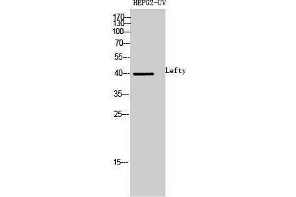 LEFTY1 anticorps  (Internal Region)