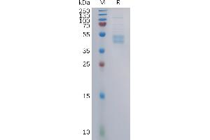 Human Protein, mFc Tag on SDS-PAGE under reducing condition. (CCR6 Protein (AA 1-47) (mFc Tag))