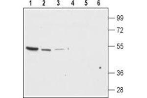 Western blot analysis of rat brain membrane (lanes 1 and 4), mouse brain (lanes 2 and 5) and mouse kidney lysates (lanes 3 and 6): - 1-3. (KCNJ13 anticorps  (Extracellular Loop))