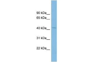 WB Suggested Anti-PTPN2 Antibody Titration: 0. (PTPN2 anticorps  (N-Term))