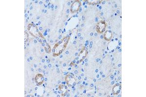 Immunohistochemistry of paraffin-embedded rat kidney using LDLRAP1 antibody. (LDLRAP1 anticorps)