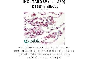 Image no. 3 for anti-TAR DNA Binding Protein (TARDBP) (AA 1-260) antibody (ABIN1723216) (TARDBP anticorps  (AA 1-260))