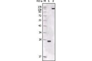 Western Blotting (WB) image for anti-FER Tyrosine Kinase (FER) (truncated) antibody (ABIN2464050) (FER anticorps  (truncated))
