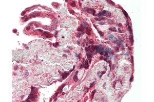 Human Placenta: Formalin-Fixed, Paraffin-Embedded (FFPE) (DAP Kinase 1 anticorps  (AA 38-374))