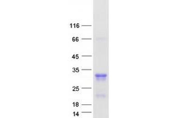 MED29 Protein (Myc-DYKDDDDK Tag)