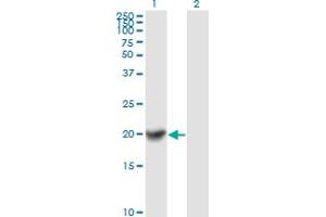 Western Blotting (WB) image for anti-Copper Metabolism (Murr1) Domain Containing 1 (COMMD1) (AA 1-190) antibody (ABIN566862)