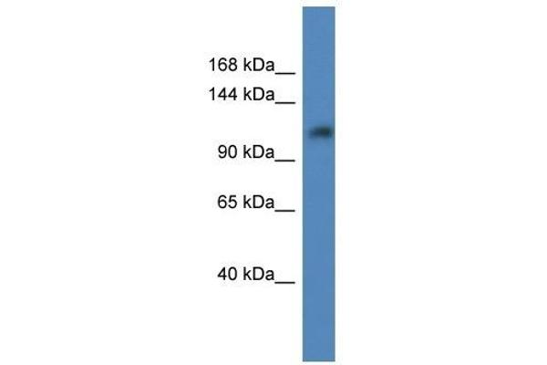 ANKRD27 anticorps  (C-Term)