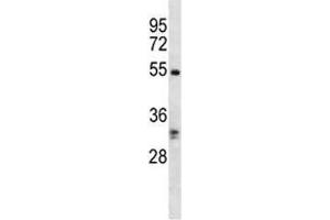 RIPK3 antibody western blot analysis in K562 lysate. (RIPK3 anticorps  (AA 480-509))