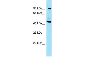WB Suggested Anti-SPECC1 Antibody Titration: 1. (NSP5 anticorps  (N-Term))