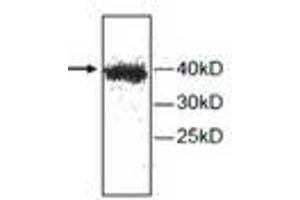 Image no. 1 for anti-Cathepsin H (CTSH) antibody (ABIN791523) (Cathepsin H anticorps)