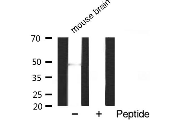 HDAC3 anticorps  (C-Term)