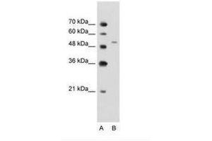 Image no. 2 for anti-Nicotinamide phosphoribosyltransferase (NAMPT) (C-Term) antibody (ABIN203416) (NAMPT anticorps  (C-Term))