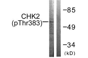 Western Blotting (WB) image for anti-Checkpoint Kinase 2 (CHEK2) (pThr383) antibody (ABIN1847336) (CHEK2 anticorps  (pThr383))