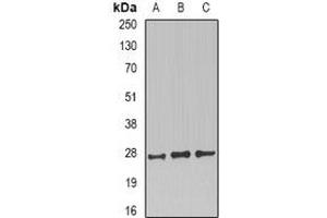 Western blot analysis of CD230 expression in SKOV3 (A), mouse brain (B), mouse kidney (C) whole cell lysates. (PRNP anticorps)