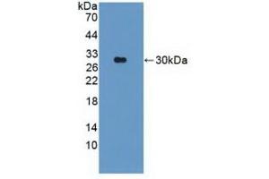 Detection of Recombinant PARK2, Human using Polyclonal Antibody to Parkinson Disease Protein 2 (PARK2) (Parkin anticorps  (AA 229-465))