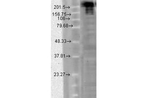 Western Blot analysis of hamster CHO cells showing detection of Nav1. (SCN9A anticorps  (AA 1751-1946) (HRP))