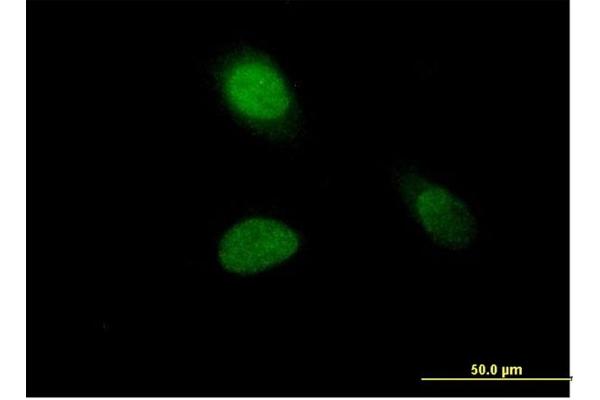 Histone H1.1 anticorps  (AA 1-215)