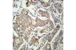 Image no. 2 for anti-BCL2-Associated Agonist of Cell Death (BAD) antibody (ABIN265323) (BAD anticorps)