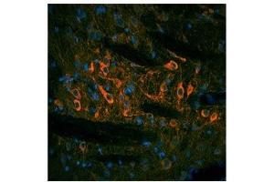 TH antibody used at a concentration of 10 ug/ml to detect substantia nigra and solitary tract in rodent brain (red). (TH anticorps  (N-Term))