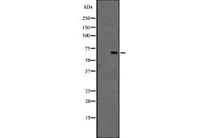 Western blot analysis of GPR44 expression in Jurkat cell lysate,The lane on the left is treated with the antigen-specific peptide. (Prostaglandin D2 Receptor 2 (PTGDR2) (Internal Region) anticorps)