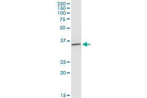 BDH1 monoclonal antibody (M03), clone 4B3. (BDH1 anticorps  (AA 1-343))