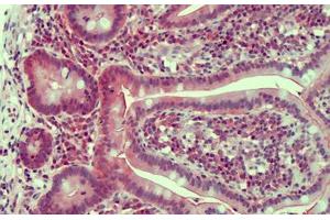 Human Small Intestine: Formalin-Fixed, Paraffin-Embedded (FFPE) (Claudin 2 anticorps  (AA 135-164))
