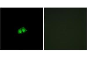Immunofluorescence analysis of A549 cells, using COPS2 Antibody. (COPS2 anticorps  (AA 181-230))