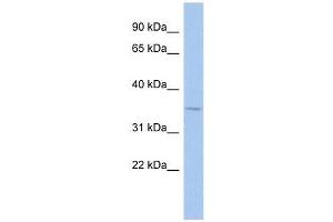 MAGEA9 antibody used at 0. (MAGEA9 anticorps  (Middle Region))