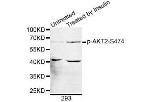 Western blot analysis of extracts of 293 cells, using Phospho-AKT2-S474 antibody (ABIN5969868). (AKT2 anticorps  (pSer474))