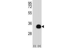 Western blot analysis of SIRT5 antibody and 293 cell lysate (2 ug/lane) either nontransfected (Lane 1) or transiently transfected (2) with the SIRT5 gene. (SIRT5 anticorps  (AA 99-127))