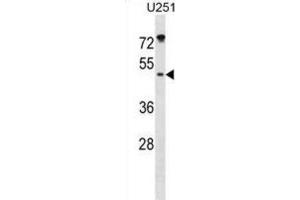 Western Blotting (WB) image for anti-Integrin-Linked Kinase-Associated Serine/threonine Phosphatase 2C (ILKAP) antibody (ABIN3000918) (ILKAP anticorps)