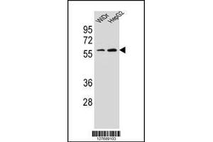 Western blot analysis in WiDr,HepG2 cell line lysates (35ug/lane). (HOXA10 anticorps  (AA 244-271))