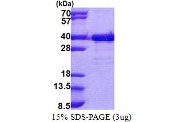 TTC35 Protein (AA 1-297) (His tag)