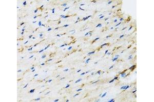 Immunohistochemistry of paraffin-embedded Rat heart using RAF1 Polyclonal Antibody at dilution of 1:100 (40x lens). (RAF1 anticorps)
