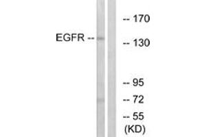 Western blot analysis of extracts from A431 cells, treated with EGF 40myM 10', using EGFR (Ab-1197) Antibody. (EGFR anticorps  (AA 1161-1210))