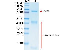 Biotinylated Cynomolgus GARP&Latent TGF beta Complex on Tris-Bis PAGE under reduced condition. (GARP & Latent TGF beta 1 Complex (AA 18-628) protein (His-Avi Tag,Biotin))