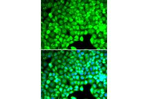 Immunofluorescence analysis of U2OS cells using CYTH2 antibody (ABIN5974231). (Cytohesin 2 anticorps)