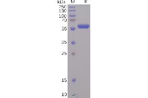 SARS-CoV-2 (2019-nCoV) S protein RBD, mFc Tag on SDS-PAGE under reducing condition. (SARS-CoV-2 Spike Protein (RBD) (mFc Tag))