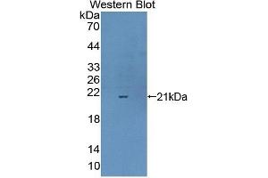 Detection of Recombinant CPLX1, Human using Polyclonal Antibody to Complexin 1 (CPLX1) (Complexin 1 anticorps  (AA 1-134))