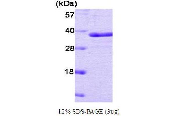 PTPN1 Protéine