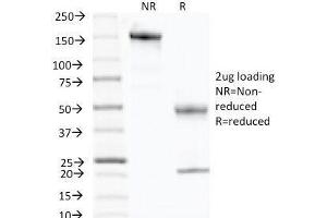 SDS-PAGE Analysis of Purified, BSA-Free p57 Antibody (clone KP10). (P57 anticorps)