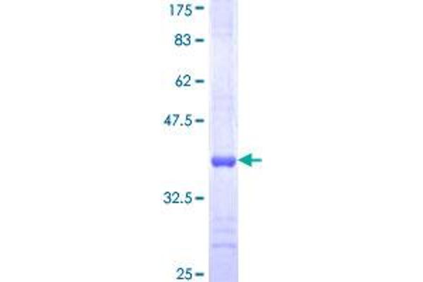 HTRA2 Protein (AA 359-458) (GST tag)