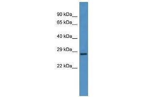 Western Blot showing CEACAM7 antibody used at a concentration of 1-2 ug/ml to detect its target protein. (CEACAM7 anticorps  (N-Term))