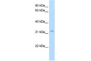 HSD17B6 antibody used at 1. (HSD17B6 anticorps  (N-Term))