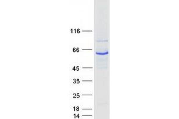 GRK1 Protein (Myc-DYKDDDDK Tag)