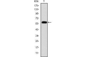 Western blot analysis using FGG mAb against human FGG (AA: 210-437) recombinant protein. (FGG anticorps)